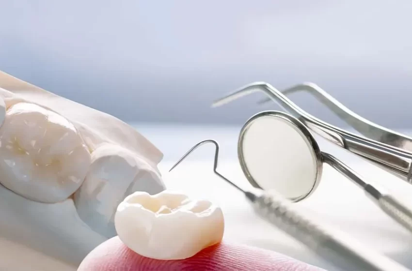  Dental Crowns vs. Other Restorations — Finding The Right Option For You